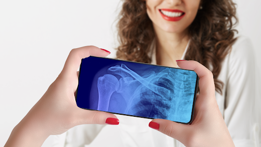 Smartphone X-Ray